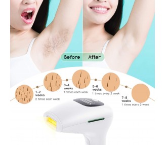 Depiladora Permanente Luz Laser IPL para Mujeres y Hombres, Cara, Piernas Axilas