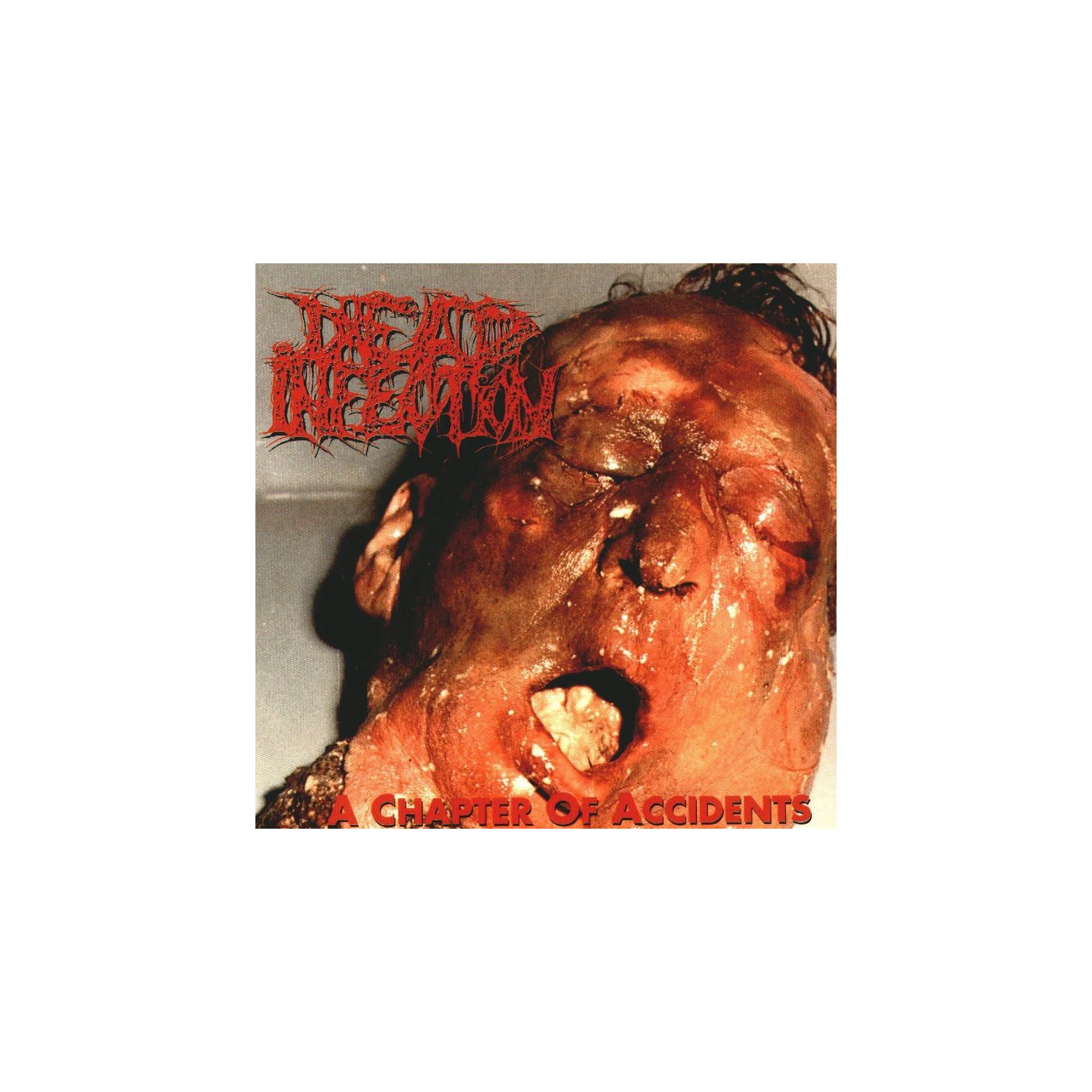 Dead Infection A Chapter Of Accidents
