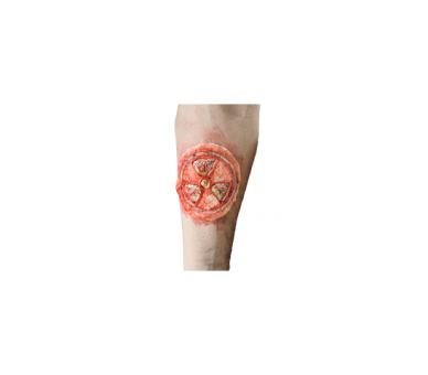 Aplicación De Látex Y Maquillaje Herida De Radiación